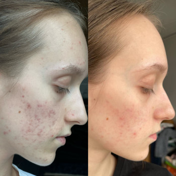 Марія Ткаченко, Киев Фото - 24