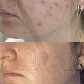 Марія Ткаченко, Киев Фото - 23