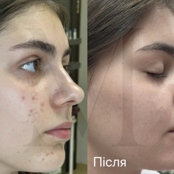 Марія Ткаченко, Киев Фото - 22