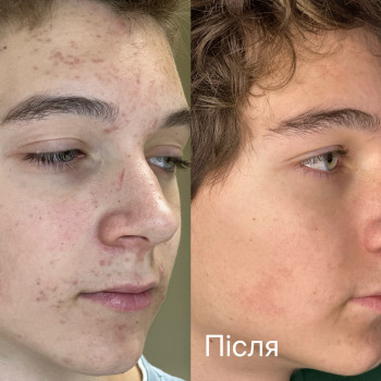 Марія Ткаченко, Киев Фото - 21