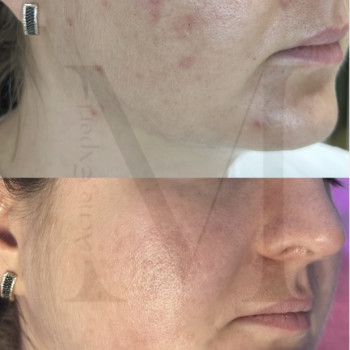 Марія Ткаченко, Киев Фото - 17