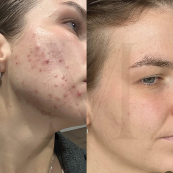 Марія Ткаченко, Киев Фото - 16