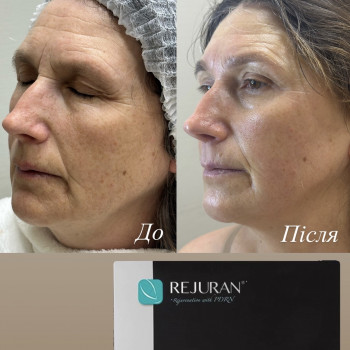 Марія Ткаченко, Киев Фото - 2