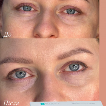 Марія Ткаченко, Киев Фото - 13