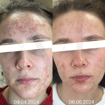 Марія Ткаченко, Киев Фото - 12