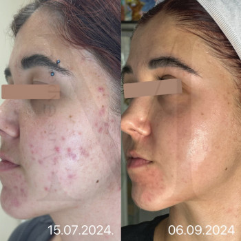 Марія Ткаченко, Киев Фото - 10