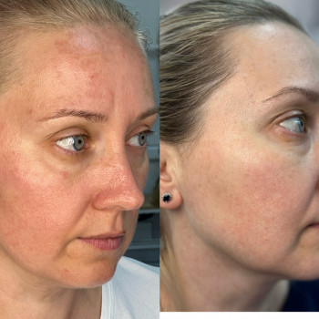 Марія Ткаченко, Киев Фото - 9