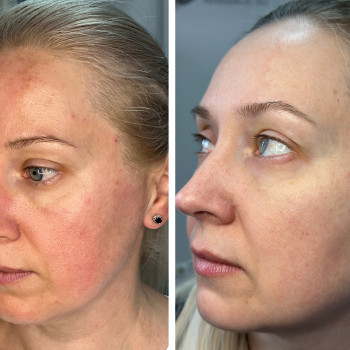 Марія Ткаченко, Киев Фото - 8