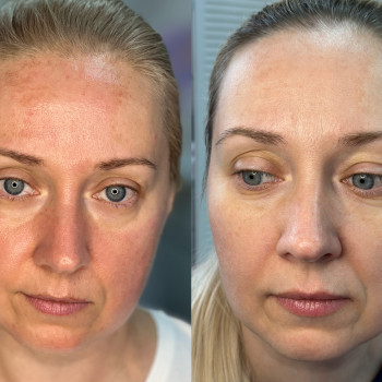 Марія Ткаченко, Киев Фото - 6