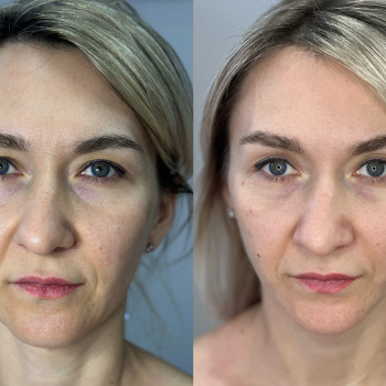 Марія Ткаченко, Киев Фото - 5