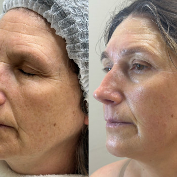 Марія Ткаченко, Киев Фото - 4