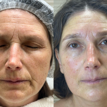 Марія Ткаченко, Киев Фото - 3