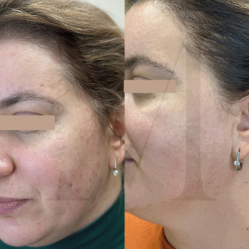 Марія Ткаченко, Киев Фото - 28