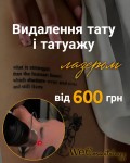 Професійне видалення тату та татуажу: акційні ціни Косметологічний центр WE Cosmetology Київ