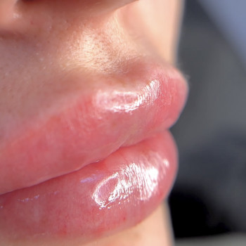 Любов Чумаченко, Запорожье Фото - 3