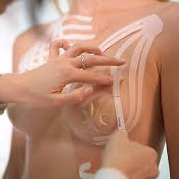 Тейпування грудей
                    Мануальный терапевт Олег Киев