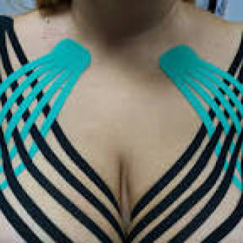 Тейпування грудей
                    Мануальный терапевт Олег Киев