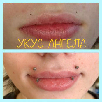Пірсинг губи «Укус Ангела»