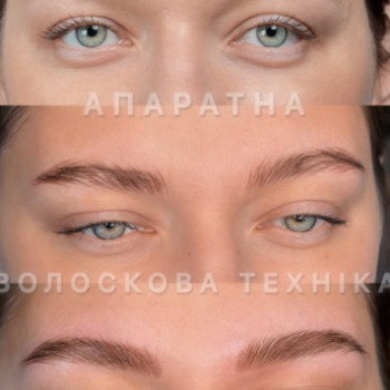 Akilova, Днепр Фото - 5