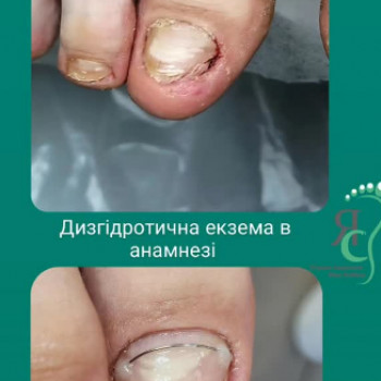 Яна Соболь, Днепр Фото - 3