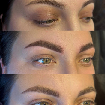 Перманент брів До, Після та Загоєний 1 процедура