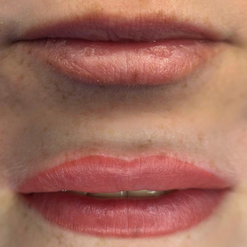 Перманент губ До та Після, фото - Майстер перманентного макіяжу Дана