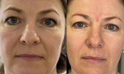  Мастер депиляции Ирина Киев