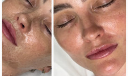  Мастер депиляции Ирина Киев