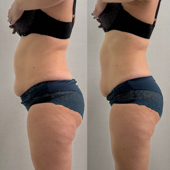 Buzko massage, Дніпро Фото - 5