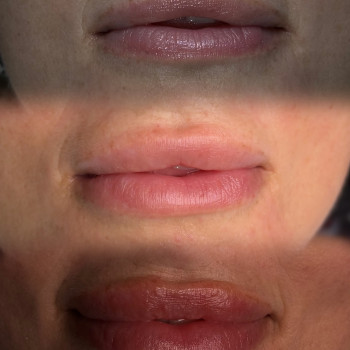 Олена Д‘яченко, Олександрія Фото - 3