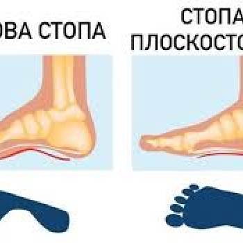 Масаж при плоскостопості
                    Мануальний терапевт Олег Київ
