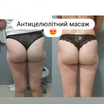 Фото из портфолио мастера Анастасія Штаченко (массажист, Знаменка)