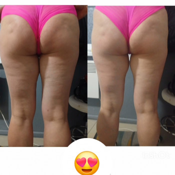 Фото из портфолио мастера Анастасія Штаченко (массажист, Знаменка)