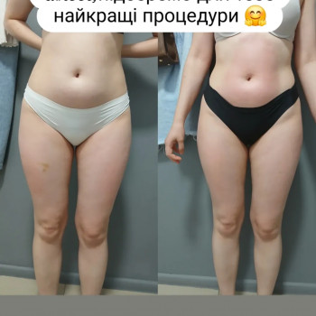 Фото из портфолио мастера Анастасія Штаченко (массажист, Знаменка)