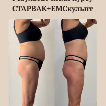 XS Massage, Днепр Фото - 5