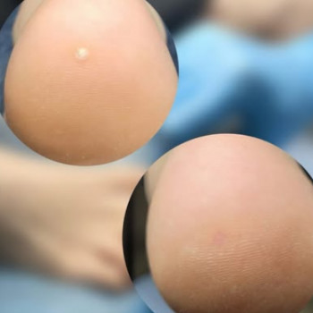 Podo Beauty, Днепр Фото - 5