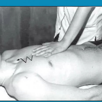 Масаж м'язів грудної клітини для пружності
                    Мануальный терапевт Олег Киев