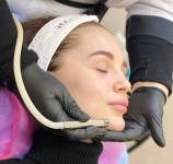 PLASMA SKIN - плазмовий душ для оновлення шкіри! Дерматолог косметолог Нелли Киев