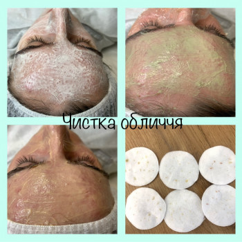Чистка обличчя комбінована