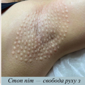 Илона , Днепр Фото - 5