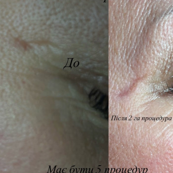 Наталія , Кременчуг Фото - 6