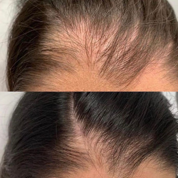 Наталія , Кременчуг Фото - 10