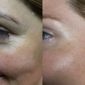 Наталія , Кременчуг Фото - 13