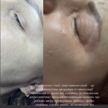 Наталія , Кременчуг Фото - 27