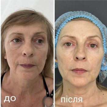 Анастасия Прийтенко, Днепр Фото - 2