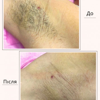 Лєна Бородуліна, Луцьк Фото - 7