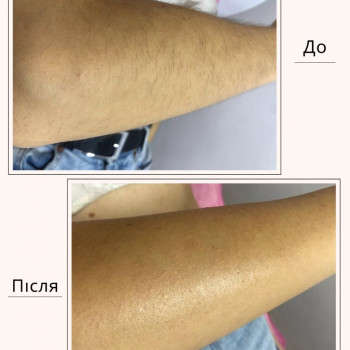 Лєна Бородуліна, Луцьк Фото - 8