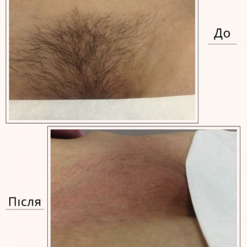 Лєна Бородуліна, Луцьк Фото - 9