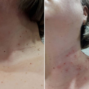 Чистота тела и кожи навсегда