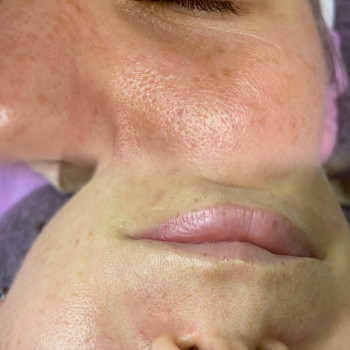 Катерина Сіліна, Миколаїв Фото - 5